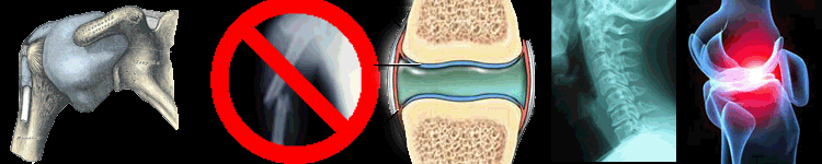 Injury prevention Rehab Personal Trainers