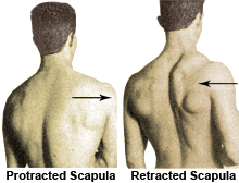 shoulder stabilization